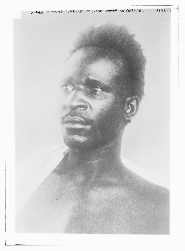 Schwarzes und weißes Foto eines Mannes mit ernster Miene, beschriftet mit 'Seneg Verletzter französischer Gefangener unter Deutschen' oben.